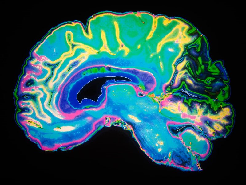 Could Viagra Help Prevent Alzheimer's? 5 1638892293 1800x1200 diabetes and dementia