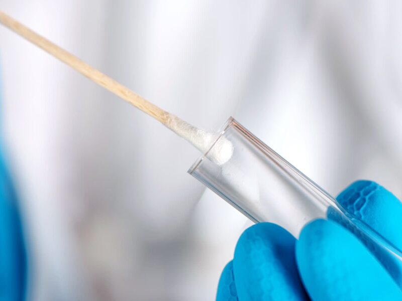 Why Getting COVID on Purpose Is a Dangerous Idea 5 1642354071 1800x1200 covid 19 testing four other