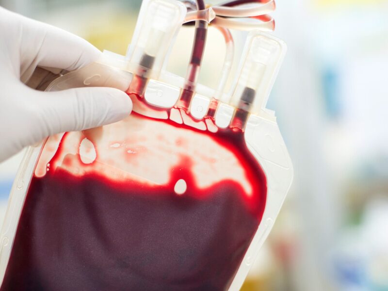 Canada Aims to End Ban on Blood Donations from Gay, Bisexual Men 6 1800x1200 blood bag close up other