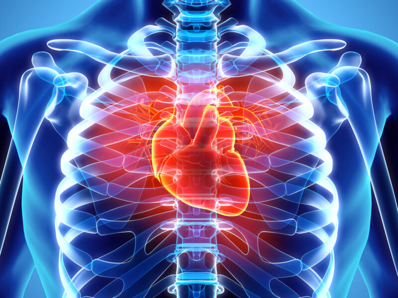 1800x1200 complications of beta thalassemia med ref