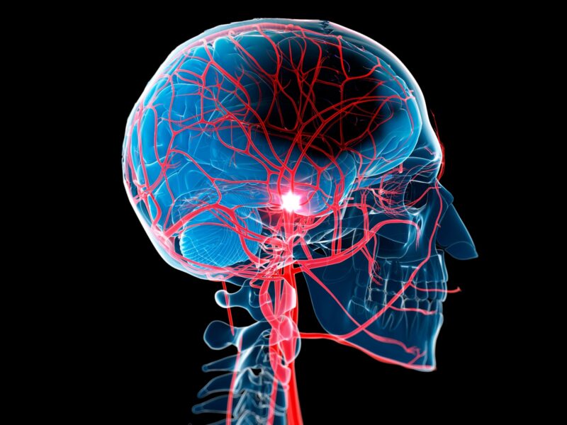 1800x1200 conditions affect men women differently slideshow