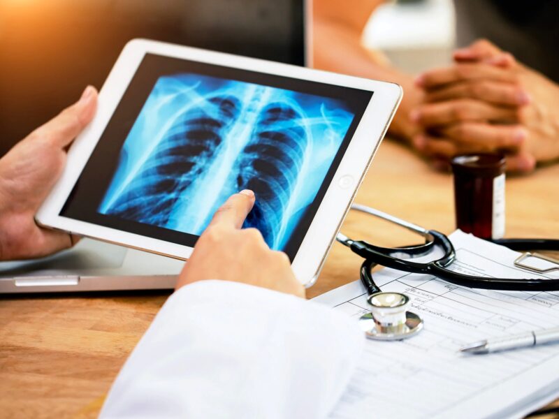 1800x1200 doctor reviewing lung xray with patient