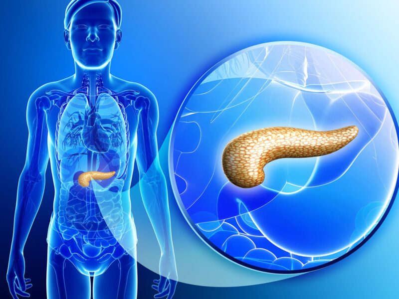 Blood Pressure Meds May Prolong Life in Pancreatic Cancer 5 1800x1200 exocrine pancreatic insufficiency ref guide