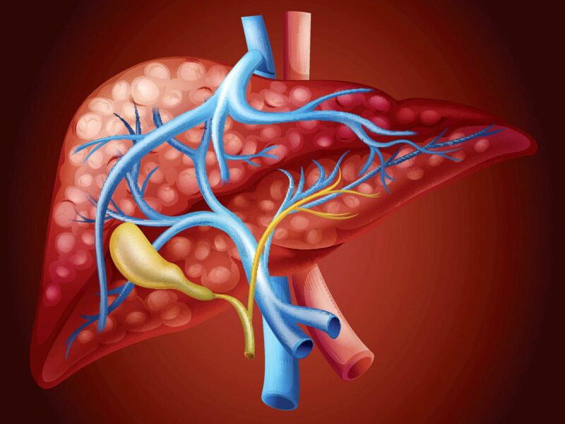 Past COVID-19 Infection Could Play Role In Child Hepatitis 4 1800x1200 hepatitis c what happens without treatment ref guide