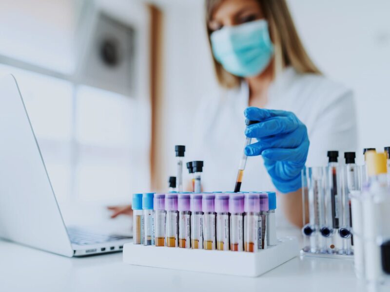 Newly Diagnosed Diabetes in COVID Patients Often Temporary 9 1800x1200 lab research covid19 2 other