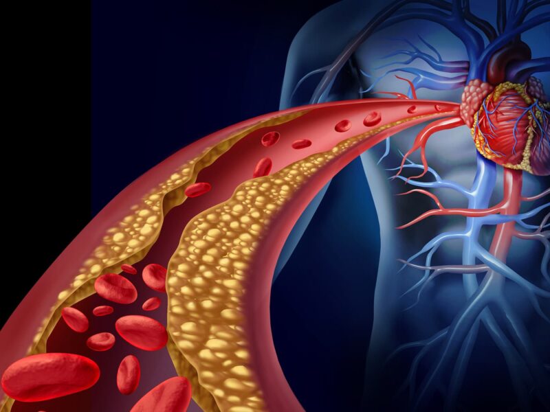1800x1200 ldl bad cholesterol ref guide