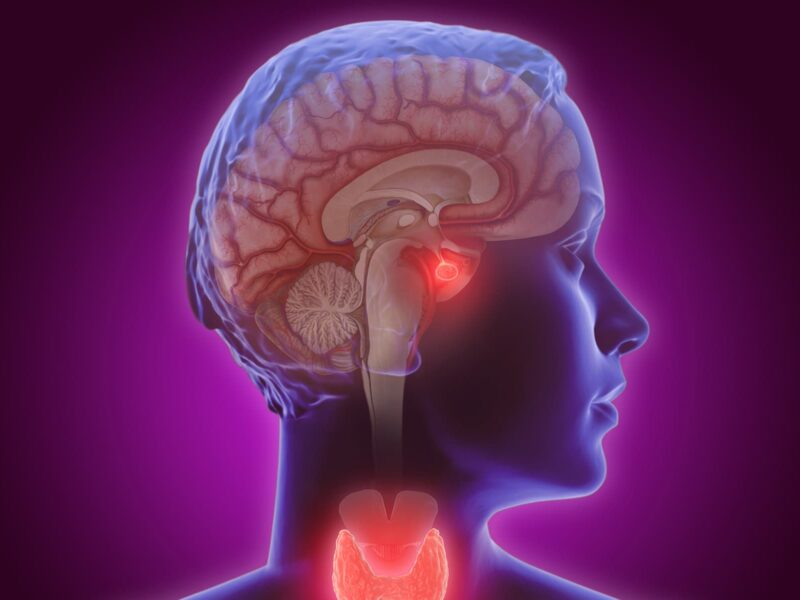 Early Menopause May Raise a Woman's Odds for Dementia 4 1800x1200 medical lifestyle brain head human pink dark 01 other