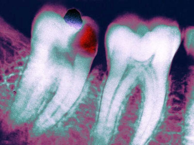 1800x1200 mouth problems slideshow