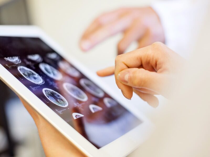 1800x1200 mri scans on digital tablet