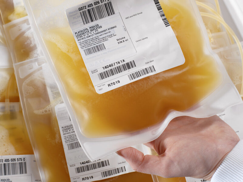 1800x1200 plasma exchange ms ref guide