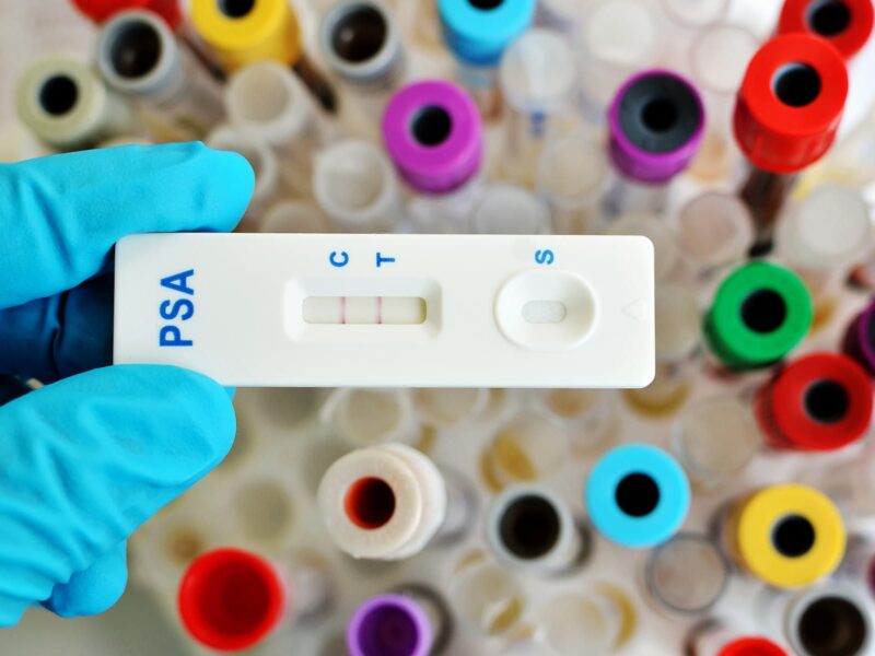 1800x1200 prostate cancer grades stages ref guide