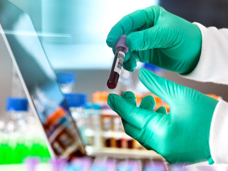 1800x1200 researcher examining blood sample other