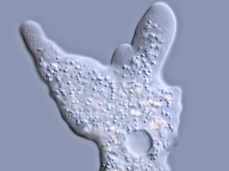 Brain-Eating Amoeba May Have Caused Nebraska Child's Death 6 1800x1200 wbz brain eating amoeba