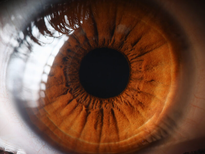 1800x1200 worst foods for your eyes