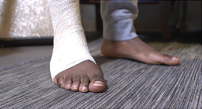 New Guidelines Urge OTC Painkillers, Not Opioids 3