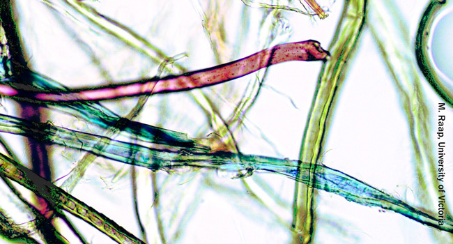 Autopsies Show Microplastics in Major Human Organs 5