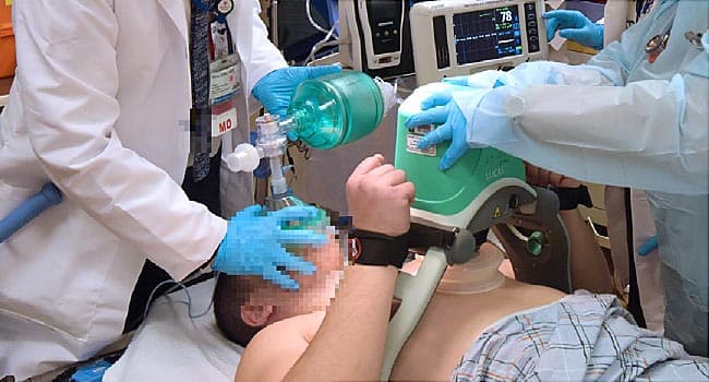 Study Shows Long COVID Affects Women More Than Men 6