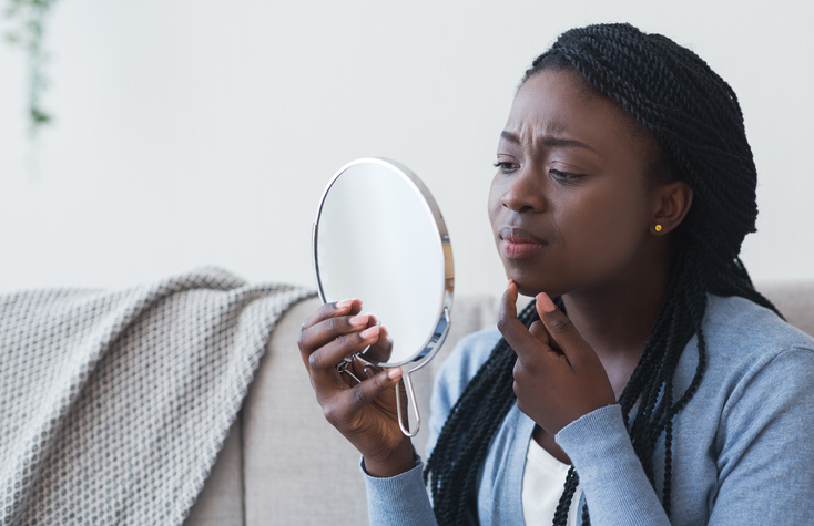 African American acne